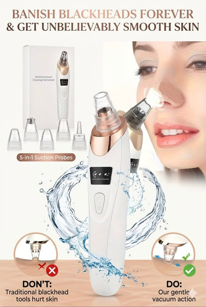 Optimistic PorePure™ Blackhead & Pore Vacuum